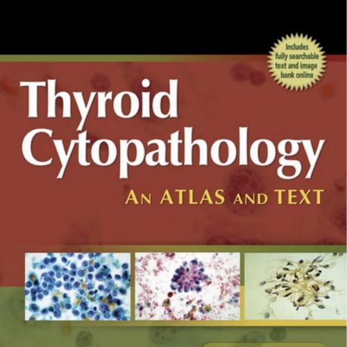 Thyroid Cytopathology-A Text and Atlas