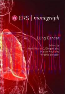 [AME]Lung Cancer 2015 (ERS Monograph)