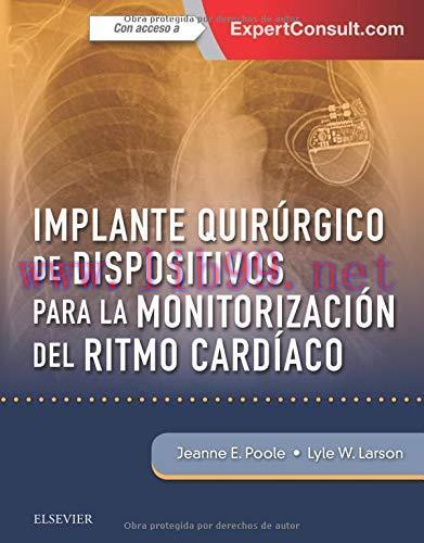 [AME]IMPLANTE QUIRURGICO DE DISPOSITIVOS PARA LA MONITORIZACION