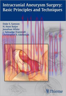 [AME]Intracranial Aneurysm Surgery: Basic Principles and Techniques