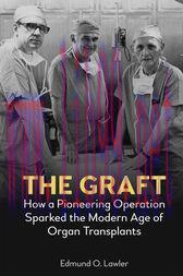 [AME]The Graft : How a Pioneering Operation Sparked the Modern Age of Organ Transplants (Origin...