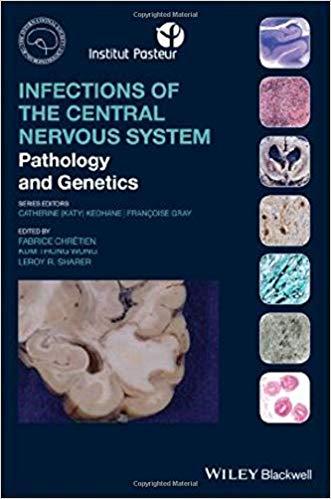 Infections of the Central Nervous System Pathology and Genetics
