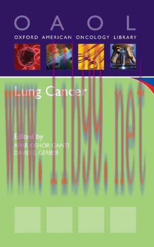 [AME]Lung Cancer (Oxford American Oncology Library)