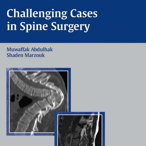 Challenging Cases in Spine Surgery