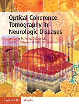 [AME]Optical Coherence Tomography in Neurologic Diseases
