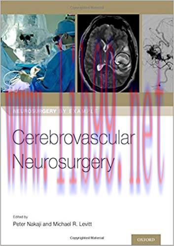 [PDF]Cerebrovascular Neurosurgery (Neurosurgery by Example)