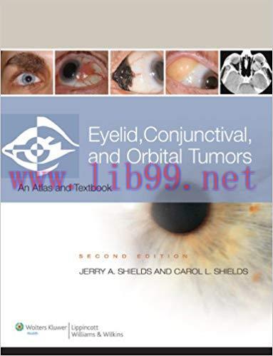[CHM]Eyelid, Conjunctival, and Orbital Tumors and Intraocular Tumors - An Atlas and Textbook, 2...