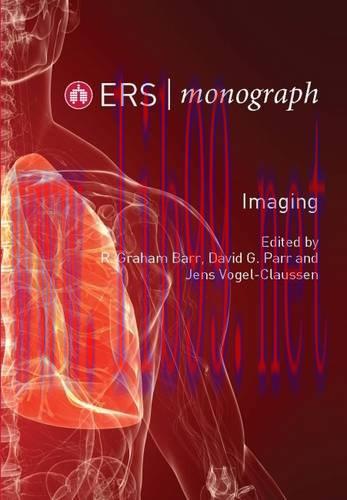 [AME]Imaging (ERS Monograph 70)