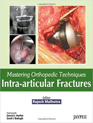Mastering Orthopedic Techniques Intra-Articular Fractures