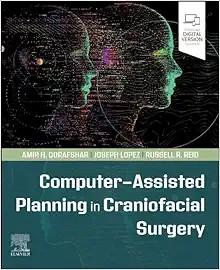 [AME]Computer-Assisted Planning in Craniofacial Surgery (True PDF from_ Publisher)
