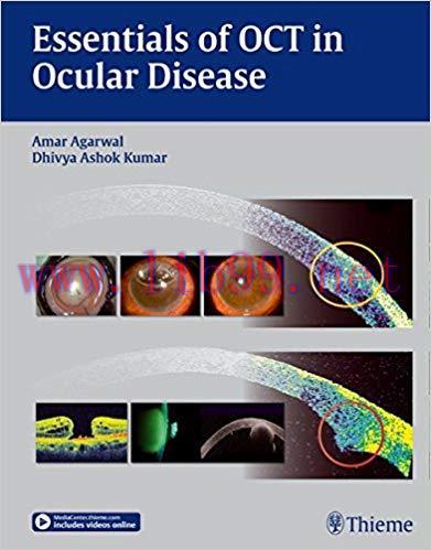 [PDF]Essentials of OCT in Ocular Disease + Videos