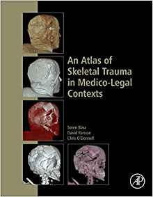An Atlas of Skeletal Trauma in Medico-Legal Contexts