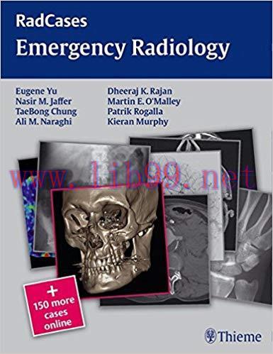 [PDF]RadCases Emergency Radiology