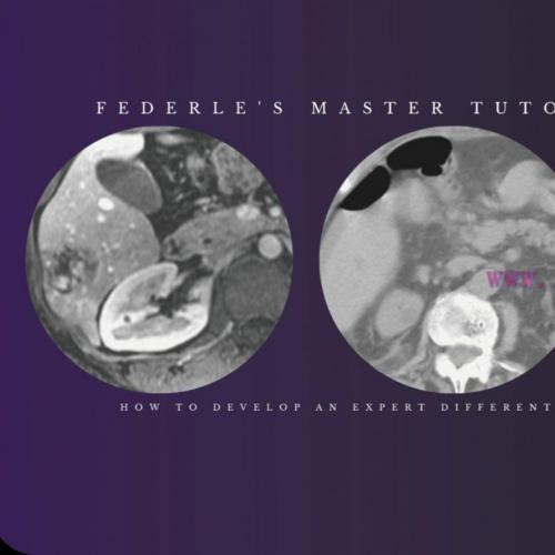 [AME]Federle&rsquo;s Master Tutorial on Abdominal Imaging: How to Develop an Expert Differential Diag...