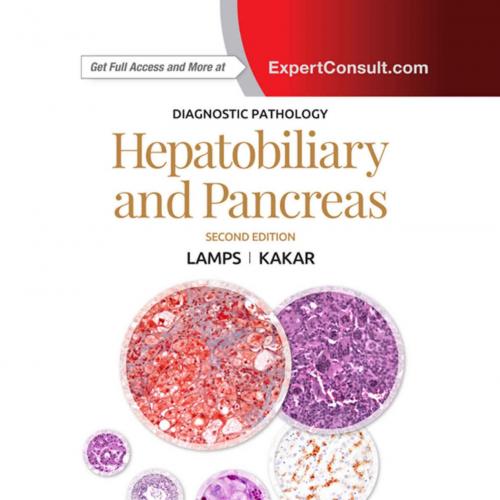Diagnostic Pathology_ Hepatobiliary and Pancreas E-Book 2th - Lamps, Laura W. & Kakar, Sanjay
