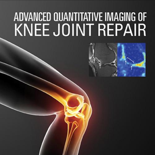 Advanced Quantitative Imaging Of Knee Joint Repair