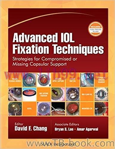 Advanced IOL Fixation Techniques: Strategies for Compromised or Missing Capsular Support 1st Ed...
