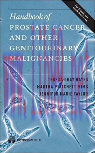 [AME]Handbook of Hematologic Malignancies (EPUB)