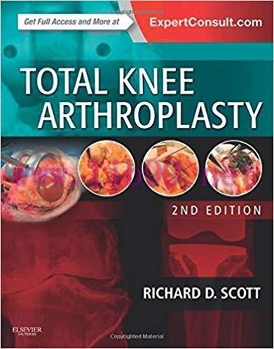 [PDF]Total Knee Arthroplasty, 2nd Edition