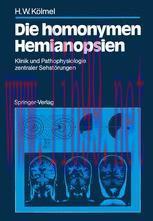 [PDF]Die homonymen Hemianopsien: Klinik und Pathophysiologie zentraler Sehst&ouml;rungen