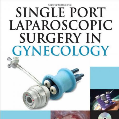 Single-Port Laparoscopic Surgery in Gynecology-Wei Zhi