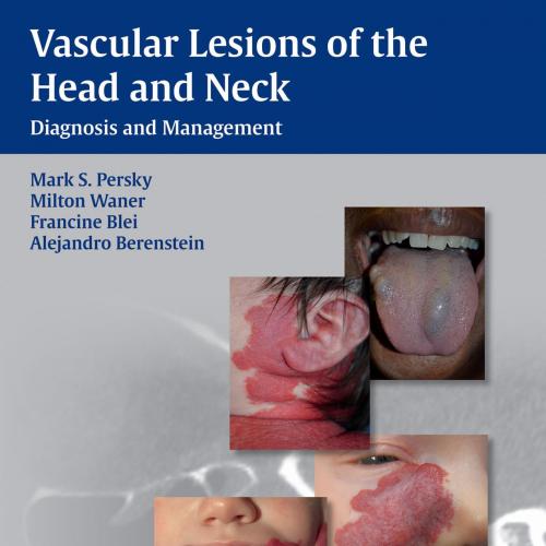 Vascular Lesions of the Head and Neck Diagnosis and Management - Mark S. Persky,Milton Waner,Fr...