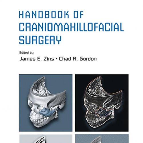Handbook of Craniomaxillofacial Surgery by James E. Zins