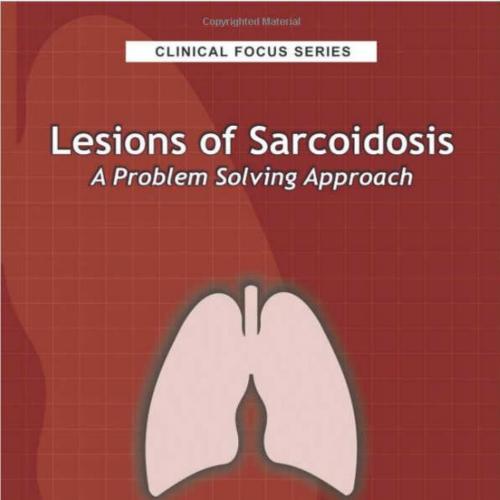 Lesions of Sarcoidosis A Problem Solving Approach