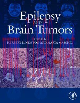 [AME]Epilepsy and Brain Tumors