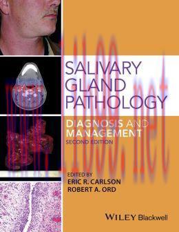 [AME]Salivary Gland Pathology: Diagnosis and Management, 2nd Edition