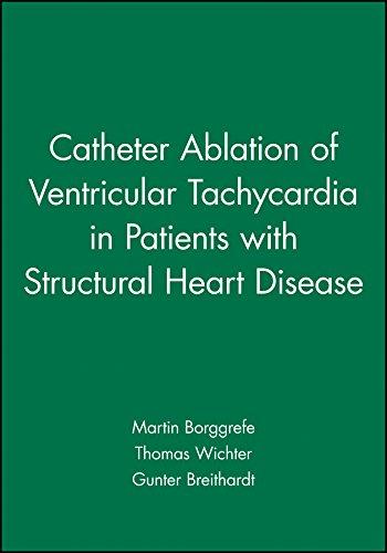 Catheter Ablation of Ventricular Tachycardia in Patients with Structural Heart Disease,volume 1...