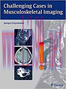 [PDF]Challenging Cases in Musculoskeletal Imaging [Thieme]