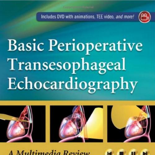 Basic Perioperative Transesophageal Echocardiography
