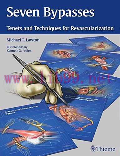 [AME]Seven Bypasses: Tenets and Techniques for Revascularization (EPUB)