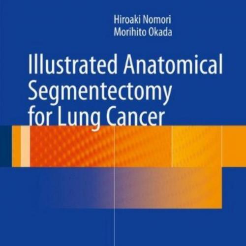 Illustrated Anatomical Segmentectomy for Lung Cancer-Springer Japan (2012)
