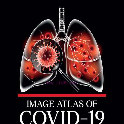 [AME]Image Atlas of COVID-19 (EPUB)