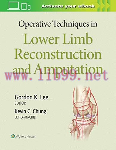 [AME]Operative Techniques in Lower Limb Reconstruction and Amputation (EPUB + Converted PDF)