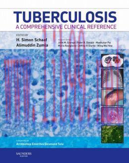 [AME]Tuberculosis: A Comprehensive Clinical Reference (ORIGINAL PDF from_ Publisher)