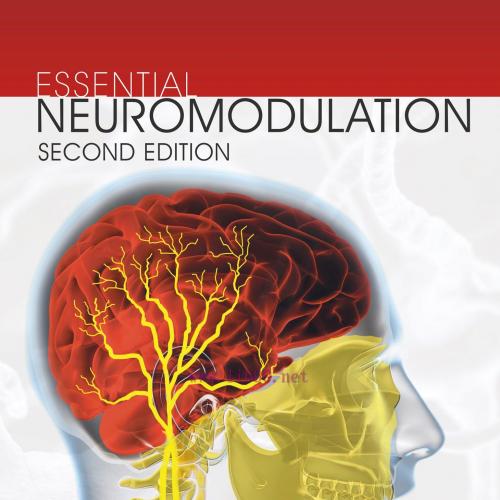 [AME]Essential Neuromodulation, 2nd Edition (EPUB)
