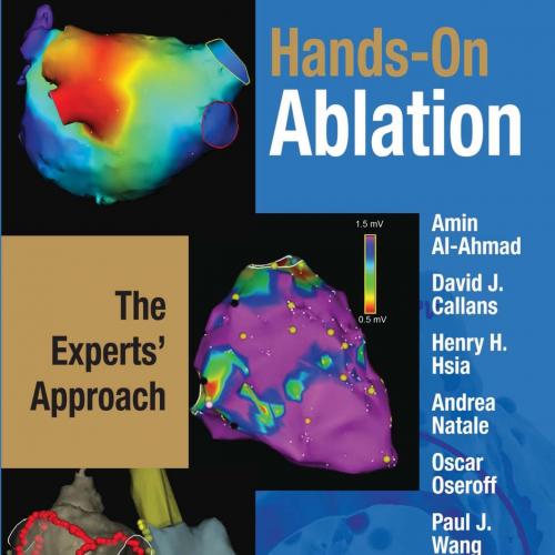 Hands-On Ablation,The Experts, Approach(Original PDF)