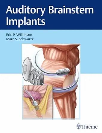 [AME]Auditory Brainstem Implants (EPUB)