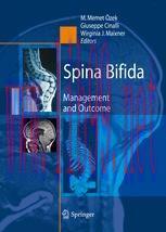 [PDF]Spina Bifida: Management and Outcome