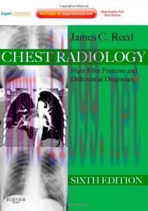 [AME]Chest Radiology: Plain Film Patterns and Differential Diagnosed, 6e (Original PDF)