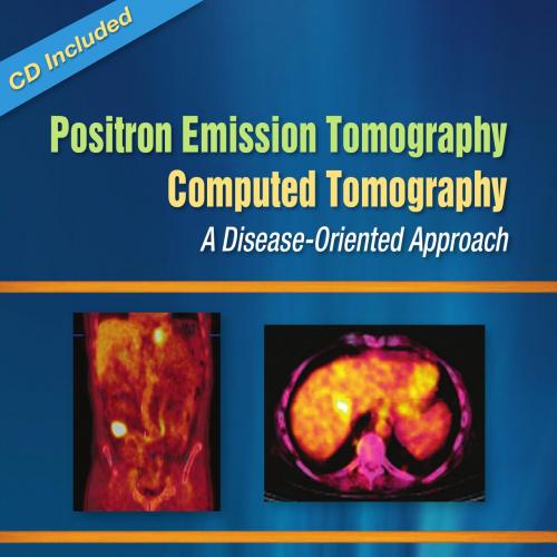 Positron Emission Tomography-Computed Tomography- A Disease-Oriented Approach