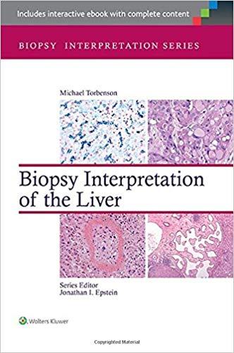 Biopsy interpretation of the liver 2015