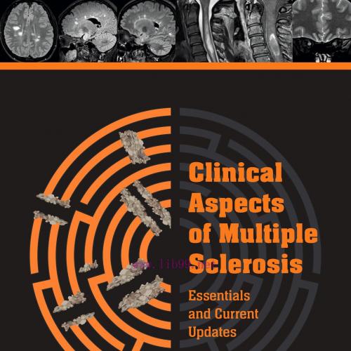[AME]Clinical Aspects of Multiple Sclerosis Essentials and Current Update_s (EPUB)