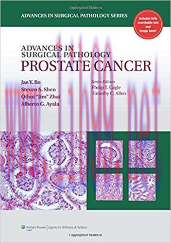 [PDF]Advances in Surgical Pathology - Prostate Cancer+CHM版