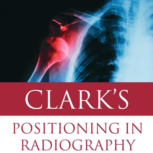 Clark's Positioning in Radiography 13E-Whitley, A. Stewart, Sloane, Charles, Hoadley, Graham, J...