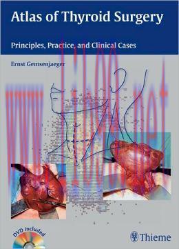 [AME]Atlas of Thyroid Surgery: Principles, Practice, and Clinical Cases