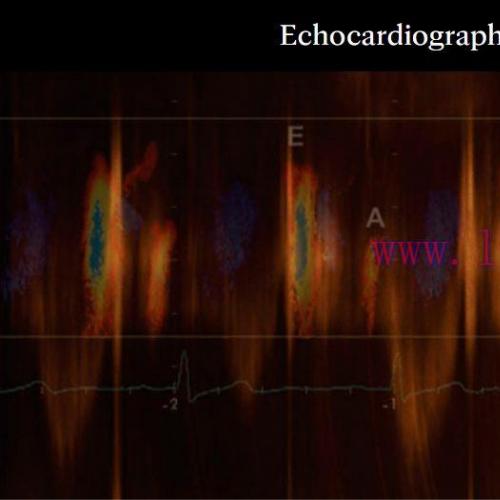 [AME]Mayo Clinic Echocardiography Online Board Review 2022 (CME VIDEOS)